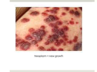 Neoplasm = new growth
 