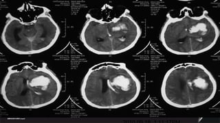 2010.09.18  1:11:17PM 