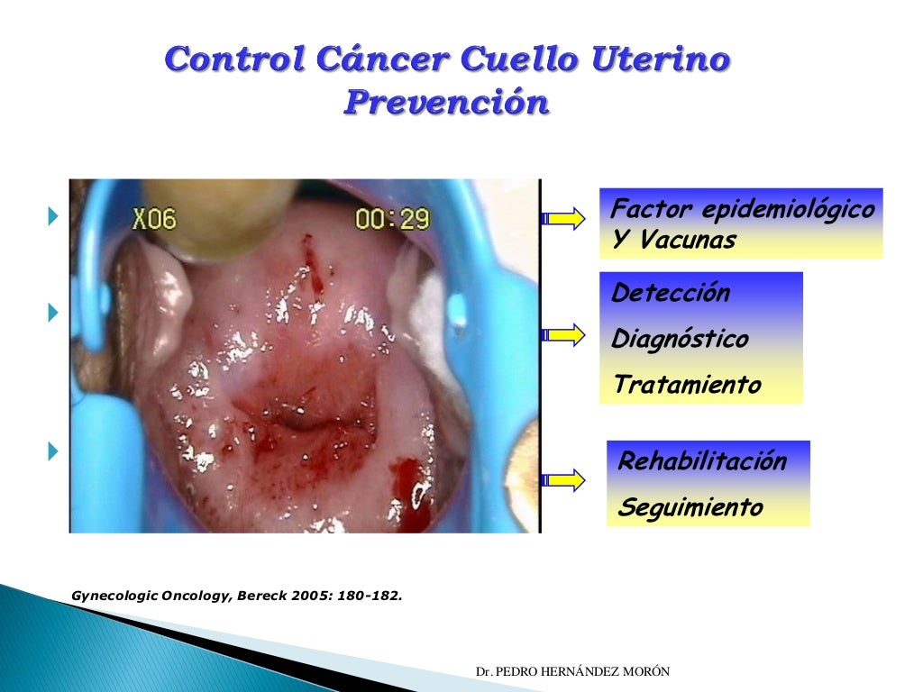 Cáncer de Cuello Uterino y NIC Screening Ene 2011