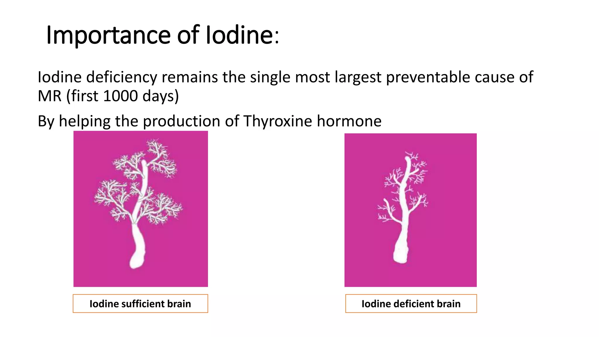 National Iodine Deficiency Disorders Control Programme NIDDCP, 2017 ...