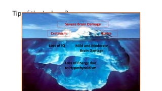 Tip of the Iceberg?
Loss of Energy due
to Hypothyroidism
Loss of IQ Mild and Moderate
Brain Damage
Cretinism Goitre
Severe Brain Damage
 