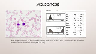 Blood indices and its interpretation .pptx