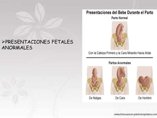 PRESENTACIONES FETALES ANORMALES 