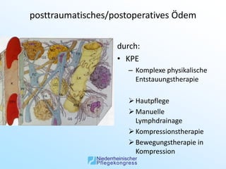 posttraumatisches/postoperatives Ödem


                   durch:
                   • KPE
                     – Komplexe physikalische
                       Entstauungstherapie

                      Hautpflege
                      Manuelle
                       Lymphdrainage
                      Kompressionstherapie
                      Bewegungstherapie in
                       Kompression
 
