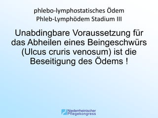 phlebo-lymphostatisches Ödem
      Phleb-Lymphödem Stadium III

 Unabdingbare Voraussetzung für
das Abheilen eines Beingeschwürs
  (Ulcus cruris venosum) ist die
    Beseitigung des Ödems !
 
