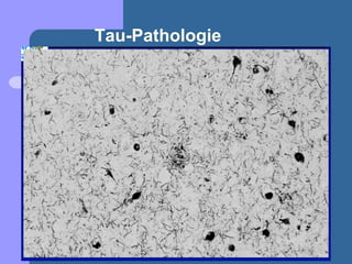 Tau-Pathologie
 