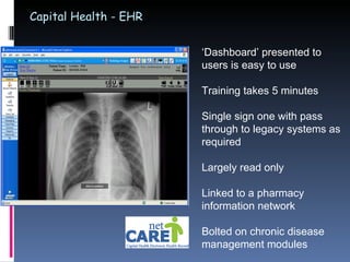 Capital Health - EHR ‘ Dashboard’ presented to users is easy to use Training takes 5 minutes Single sign one with pass through to legacy systems as required Largely read only Linked to a pharmacy information network Bolted on chronic disease management modules 