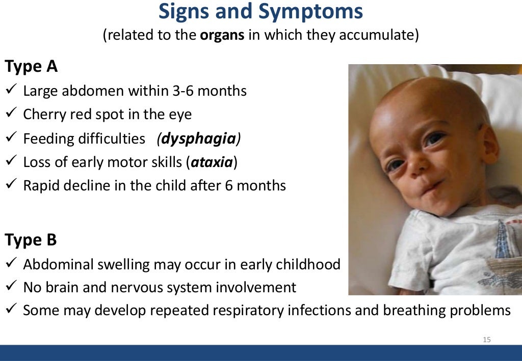 Niemann Pick Disease (Nafisa Nawal Islam)