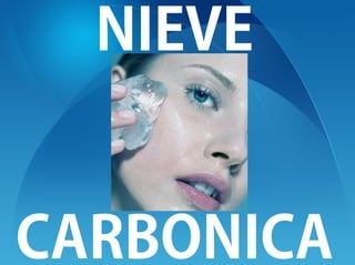 Nieve Carbonica