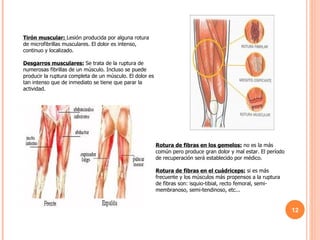 Tirón muscular:   Lesión producida por alguna rotura de microfibrillas musculares. El dolor es intenso, continuo y localizado. Desgarros musculares:   Se trata de la ruptura de numerosas fibrillas de un músculo. Incluso se puede producir la ruptura completa de un músculo. El dolor es tan intenso que de inmediato se tiene que parar la actividad. Rotura de fibras en los gemelos:  no es la más común pero produce gran dolor y mal estar. El período de recuperación será establecido por médico. Rotura de fibras en el cuádriceps:  si es más frecuente y los músculos más propensos a la ruptura de fibras son: isquio-tibial, recto femoral, semi-membranoso, semi-tendinoso, etc... 