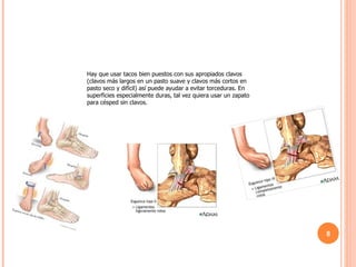 Hay que usar tacos bien puestos con sus apropiados clavos (clavos más largos en un pasto suave y clavos más cortos en pasto seco y difícil) así puede ayudar a evitar torceduras. En superficies especialmente duras, tal vez quiera usar un zapato para césped sin clavos. 