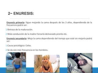 Enuresis primaria: Sigue mojando la cama después de los 3 años, dependiendo de la
frecuencia podrá ser:
1.Retraso de la maduración.
2.Mala conducción de la madre Forzarlo demasiado pronto etc.
Enuresis secundaria: Moja la cama dependiendo del tiempo que esté sin mojarla podrá
ser:
1.Causa psicológica: Celos.
2.Se da con más frecuencia en los hombres.
2− ENURESIS:
 
