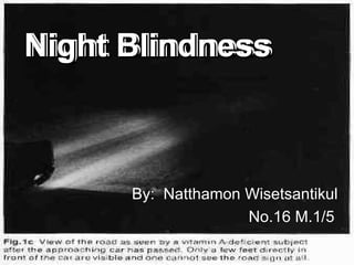 Night Blindness   By:  Natthamon Wisetsantikul No.16 M.1/5 Night Blindness   
