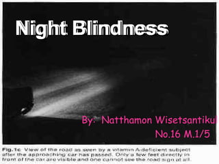 Night Blindness   By:  Natthamon Wisetsantikul No.16 M.1/5 Night Blindness   