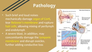 noise induced hearing loss ent prsentation.pptx