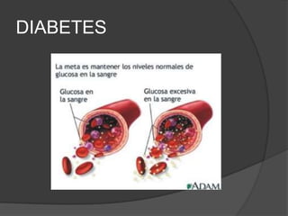 DIABETES
 