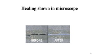 Healing shown in microscope
14
 