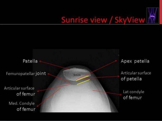 MRI KNEE JOINT ANATOMY
