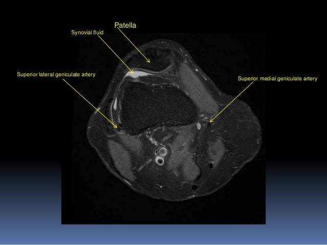 MRI KNEE JOINT ANATOMY