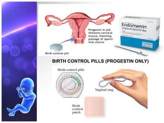 BIRTH CONTROL PILLS (PROGESTIN ONLY)
 