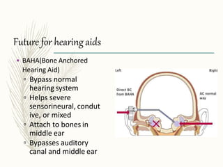 Future for hearingaids
• BAHA(Bone Anchored
Hearing Aid)
▫ Bypass normal
hearing system
▫ Helps severe
sensorineural, condut
ive, or mixed
▫ Attach to bones in
middle ear
▫ Bypasses auditory
canal and middle ear
 