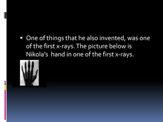  One of things that he also invented, was one 
of the first x-rays. The picture below is 
Nikola’s hand in one of the first x-rays. 
 