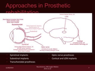 Artificial Vision & Neuroprosthetics | PDF