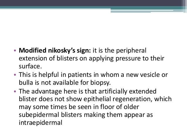 nikolsky sign nikolsky sign