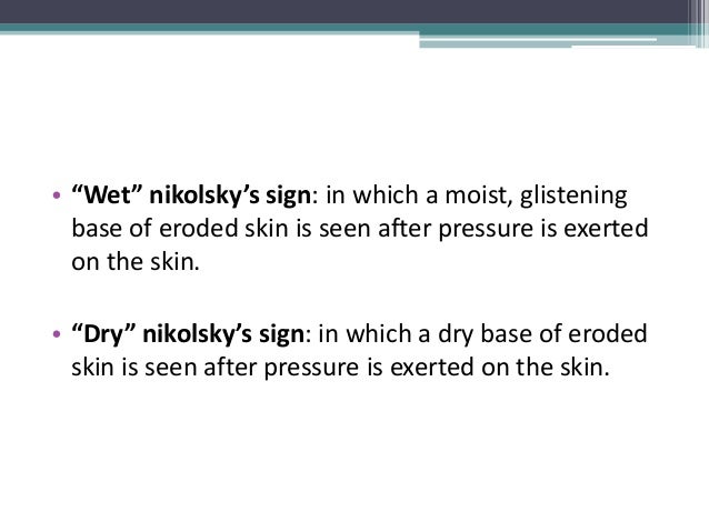 nikolsky sign nikolsky sign