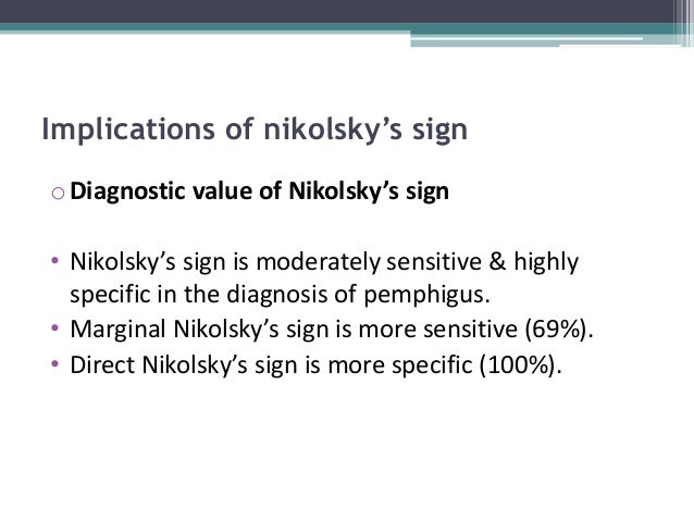 nikolsky sign nikolsky sign