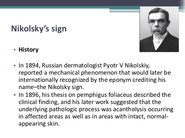 nikolsky sign nikolsky sign