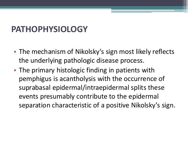nikolsky sign nikolsky sign