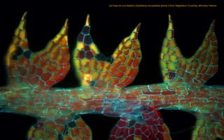 Las hojas de una hepática (Cephalozia bicuspidata) planta (125x). Magdalena Turzańska, Wroclaw, Polonia
 