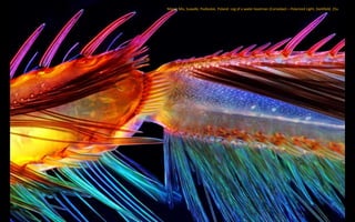 Marek Mis, Suwalki, Podlaskie, Poland: Leg of a water boatman (Corixidae) – Polarized Light, Darkfield, 25x
 