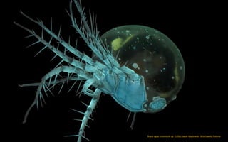 Ácaro agua Unionicola sp. (100x). Jacek Myslowski, Wloclawek, Polonia
 