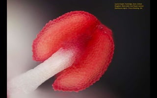 Laurie Knight, Tonbridge, Kent, United
Kingdom: Black elder tree flower stamen
(Sambucus nigra) – Focus Stacking, 10x
 