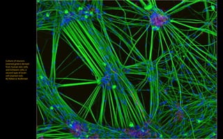Culture of neurons
(stained green) derived
from human skin cells,
and Schwann cells, a
second type of brain
cell (stained red).
By Rebecca Nutbrown
 