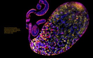Testis of a fruit fly (Drosophila
pseudoobscura) stained for DNA and
pseudocolored for depth, showing the
stages of sperm development.
By Christopher Large
 