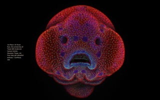 1st Place: Dr Oscar
Ruiz, the University of
Texas MD Anderson
Cancer Center,
Houston, Texas, US:
Four-day-old zebrafish
embryo – Confocal,
10x
 