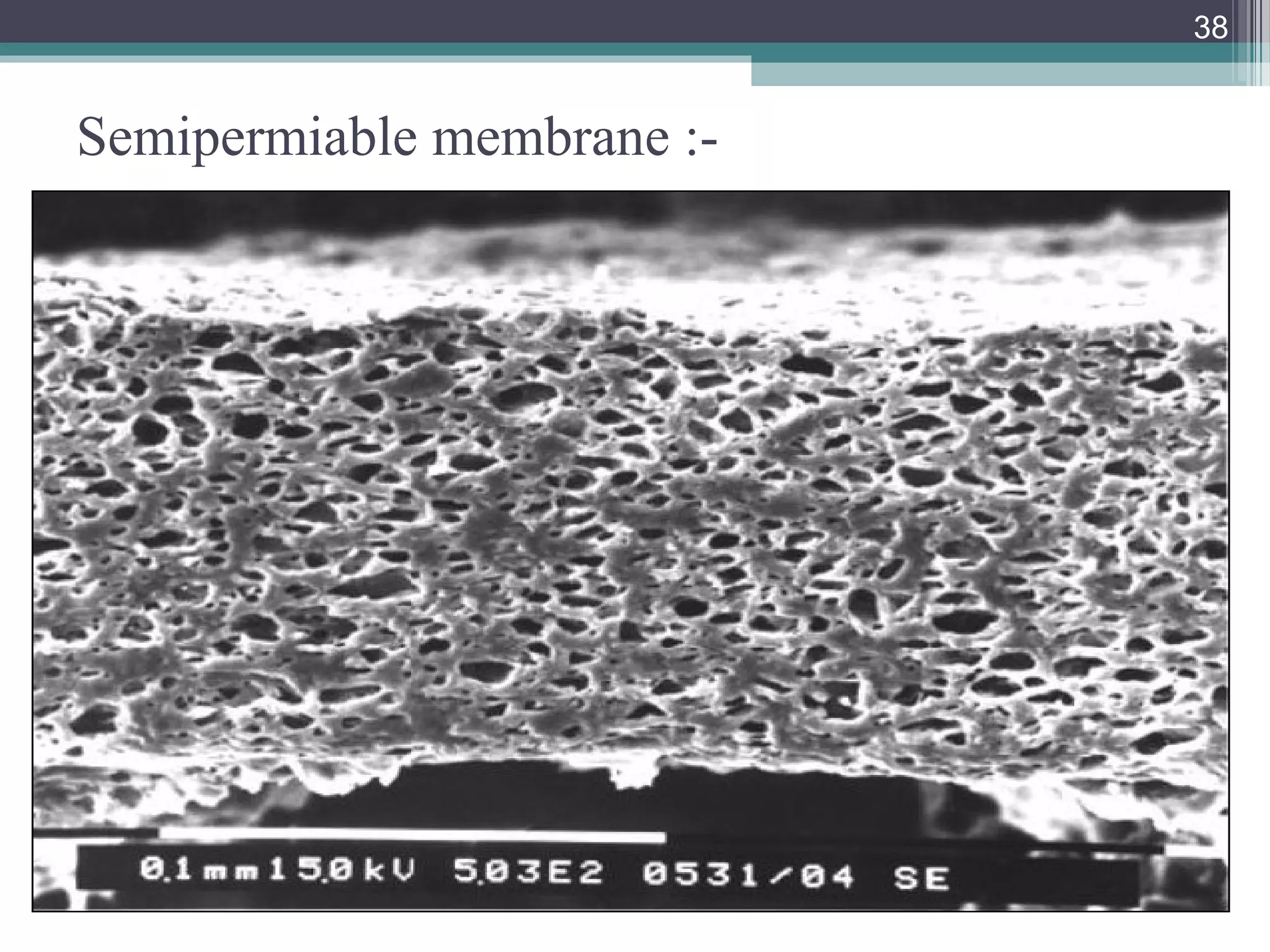 Semipermiable membrane :-
38
 