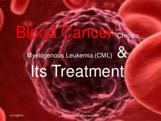 Blood Cancer Chronic
Myelogenous Leukemia (CML) &
Its Treatment
12/13/2016 www.cancercurepharmacy.com
 