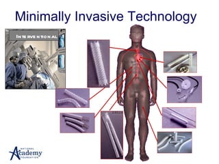 Minimally Invasive Technology Interventional 