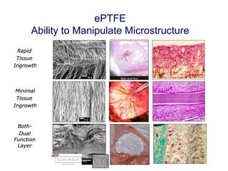 ePTFE Ability to Manipulate Microstructure Rapid  Tissue  Ingrowth Minimal Tissue  Ingrowth Both- Dual Function Layer DLMC F P 