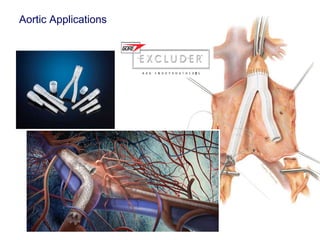 Aortic Applications 