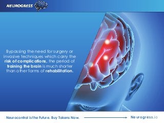 Neurogress.ioNeurocontrol is the Future. Buy Tokens Now.
Bypassing the need for surgery or
invasive techniques which carry the
risk of complications, the period of
training the brain is much shorter
than other forms of rehabilitation.
 