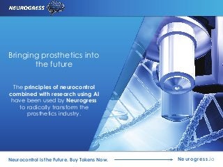 Neurogress.ioNeurocontrol is the Future. Buy Tokens Now.
Bringing prosthetics into
the future
The principles of neurocontrol
combined with research using AI
have been used by Neurogress
to radically transform the
prosthetics industry.
 