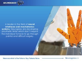 Neurogress.ioNeurocontrol is the Future. Buy Tokens Now.
A leader in the field of neural
interfaces and mechatronics
systems, Neurogress are developing
prosthetic limbs which don’t require
the individual to have to go through
painful and difficult surgery.
 