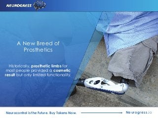 A New Breed of
Prosthetics
Historically, prosthetic limbs for
most people provided a cosmetic
result but only limited functionality.
Neurogress.ioNeurocontrol is the Future. Buy Tokens Now.
 