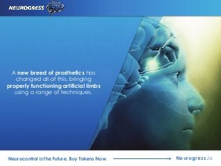 A new breed of prosthetics has
changed all of this, bringing
properly functioning artificial limbs
using a range of techniques.
Neurogress.ioNeurocontrol is the Future. Buy Tokens Now.
 