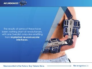 The results of some of these have
been nothing short of revolutionary,
with one Swedish amputee enefiting
from implanted neuromuscular
interfaces.
Neurogress.ioNeurocontrol is the Future. Buy Tokens Now.
 
